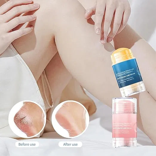 Cracked Skin Repair Cream, Winter Anti-Cracking Frost, Vegan Foot Cream for Dry, Rough and Cracked Feet, Protects and Binds Moisture, Foot Care Cream (Pack of 2)